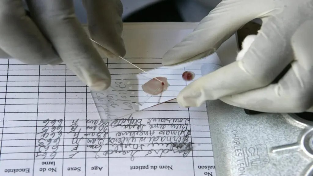 América en 2023: 342 personas murieron a causa de la malaria, según la OMS